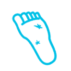 Neuropathy